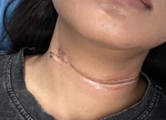 Kabel Wifi Sembraut di Pekanbaru Kembali Makan Korban