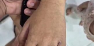 Fenomena Kemarau DAS Kampar, Warga Terpapar Wabah, Diduga Zat Berbahaya