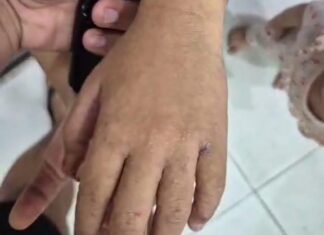 Fenomena Kemarau DAS Kampar, Warga Terpapar Wabah, Diduga Zat Berbahaya