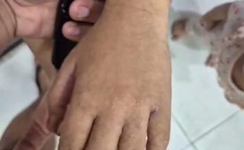 Fenomena Kemarau DAS Kampar, Warga Terpapar Wabah, Diduga Zat Berbahaya